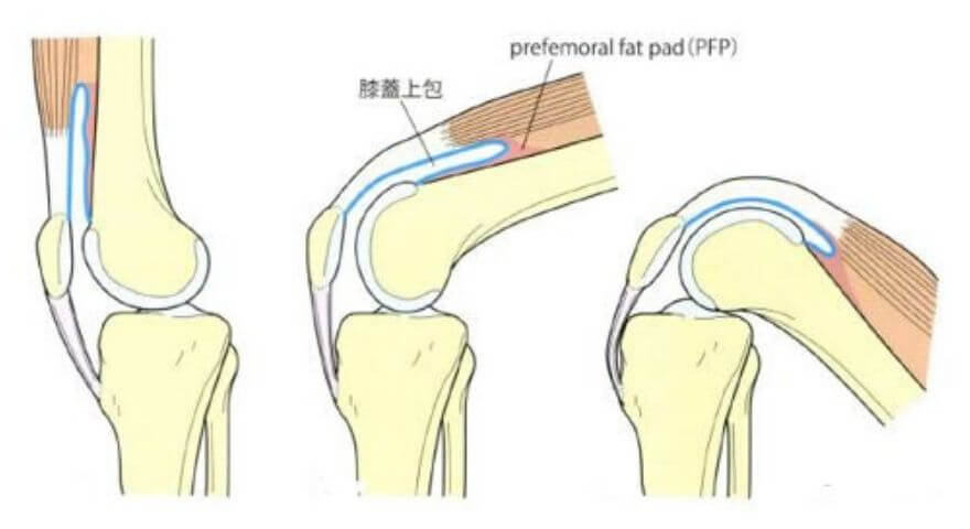 膝蓋上嚢の動き